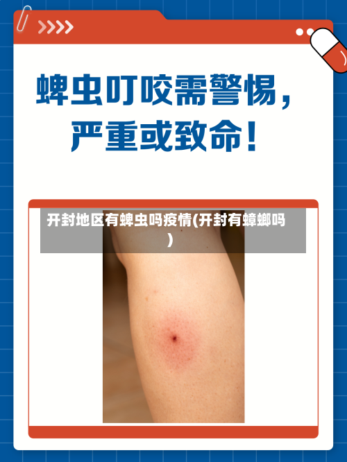 开封地区有蜱虫吗疫情(开封有蟑螂吗)