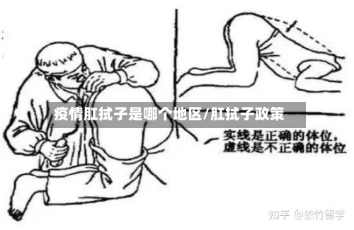 疫情肛拭子是哪个地区/肛拭子政策-第2张图片