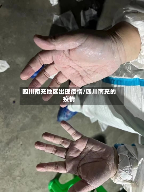 四川南充地区出现疫情/四川南充的疫情
